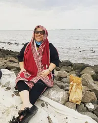 10 Potret Nunung yang Rambutnya Habis Pasca Jalani Kemoterapi, Kini Ke Mana-Mana Selalu Pakai Turban Maupun Wig - Akui Sempat Sedih dan Menangis