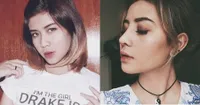 7 Seleb Ini Lakukan Operasi Hidung, Simak Foto Perbedaan Before-Afternya