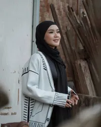 8 Potret Cita Rahayu Ungkap Penyakit Autoimun yang Ia Derita, Ngaku Suntik Putih Jadi Penyebab Utama