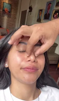8 Potret Farida Nurhan Operasi Plastik Hidung Lagi, Tak Mau Disebut Mirip Suneo - Dicibir Netizen: Jilat Ludah Sendiri