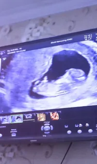 8 Potret Kiki Amalia Umumkan Kehamilan Pertama di Usia 41 Tahun, Sudah 15 Minggu - Suami Super Bahagia
