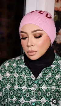 8 Potret Melly Goeslaw Pasca Lakukan Operasi Bariatik, Turun 6 Kg Dalam 9 Hari - Pipi Makin Tirus