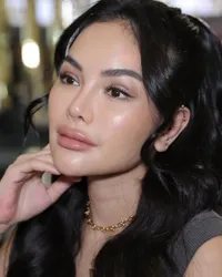 8 Potret Wajah Baru Nikita Mirzani Usai Oplas di Korea, Disebut Makin Cantik Hingga Mirip Nindy Ayunda