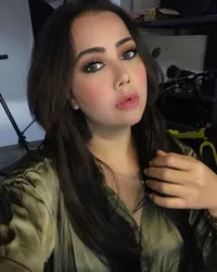 Dagu Bernanah, Ini 5 Potret Cantik Rency Milano Sebelum Terkena Malpraktik