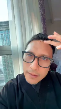 Dahi Arie Untung Bocor di Mekkah, Alami Insiden Tak Terduga Saat Umrah