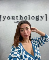 Demi Glowing dan Kinclong, Intip 8 Potret Selvi Kitty Rela Jalani Perawatan Kecantikan Sampai Mukanya Merah-Merah