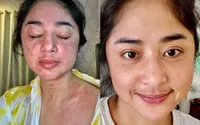 Deretan Seleb Tanah Air yang Ungkap Dirinya Positif Covid-19 Lewat IG, Ada Dewi Perssik Sampai Pevita Pearce