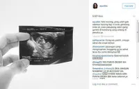 FOTO: Baby Bump Ayudia Bing Slamet, Makin Stylish & Dimanja Suami