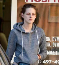 Foto dan Kejadian 'Memalukan' Yang Pernah Dialami Kristen Stewart
