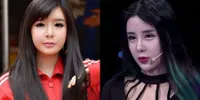 FOTO: Gadis China 16 Tahun Lakukan Oplas, Kini Mirip Bom 2NE1?