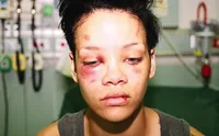 FOTO: Miris, 10 Seleb Hollywood Ini Babak Belur Karena KDRT
