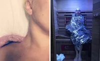 Foto: Para Seleb Hollywood Yang Hidup Bersama Penyakitnya