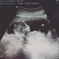 FOTO: Persiapan Nina Zatulini & Suami Sambut Kelahiran Buah Hati