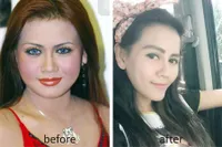FOTO Wajah Cantik Hasil Oplas Nita Thalia, Seajaib Boneka Barbie!