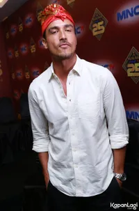 FOTO: Wajah Penuh Baut, Kisah Hamish Daud Amnesia Sampai 9 Bulan