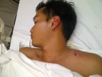 Foto Rezky Aditya Pasca Kecelakaan - di RS Pondok Indah