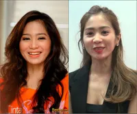 Ini Bukti Perubahan Drastis Wajah Bunga Zainal, Dituding Oplas!