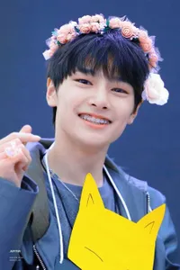 Inilah 10 Idol K-Pop yang Sempat Memakai Behel, Ada yang Makin Kelihatan Imut Loh!