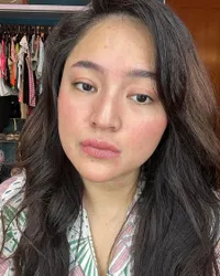 Marshanda Pamer Wajah Merah-Merah & Jerawat Beruntusan, Komentar Gombal Vicky Prasetyo Jadi Sorotan