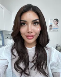 Millen Cyrus Diduga Oplas 'Ganti Kepala' Seperti Lucinta Luna, Intip Transformasinya Setelah Pasang Filler Bak Angelina Jolie