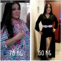Nggak Nyangka! Ternyata Sederet Seleb Ini Pernah Sedot Lemak Lho