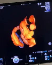 Potret Baby Guzelim Anak Ali Syakieb dan Margin Wieheerm, Punya Mata Hidung Cantik - Sadar Kamera