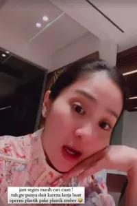 Potret Bunga Zainal Disebut Lakukan Operasi Plastik, Berang Sampai Minta Dibayar Jika Bisa Buktikan