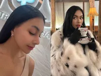 Penampilan Jadi Beda, Ini Potret Denada Sebelum dan Sesudah Oplas Hidung, Bikin Pangling