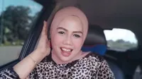 Potret Elly Sugigi yang Kerap Dapatkan Bullyan dari Netizen, Disebut Tak Bisa Ciuman Karena Bentuk Gigi