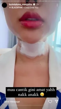 Potret Hasil Operasi 'Tembolok' Lucinta Luna Luka Masih Basah, Hilangkan Suara Khodam - Bikin Ngilu Gak Bisa Nelan