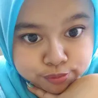 Potret Kekeyi Lakukan Filler Hidung, Hasilnya Bikin Melongo - Banjir Hujatan Netizen