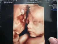 Potret Nella Kharisma Dan Dory Harsa yang Kini Makin Mesra, Bakal Segera Dikaruniai Anak Kedua