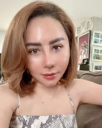 Potret Terbaru Femmy Permatasari Usai Oplas di Korea, Ngaku Masih Sakit Karena Ambil Tulang Iga Untuk Bikin Mancung