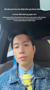 Potret Vidi Aldiano Curiga Kulit Lebih Putih Karena Obat Kemo, Takut Jadi Edward Cullen