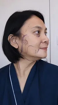 Potret Wajah Dian Nitami Setelah Sebulan Operasi Face Lifting, Puas Kulitnya Terasa Kencang dan Hasilnya Natural