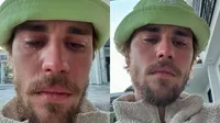 Justin Bieber Unggah Foto Menangis, Komentar Hailey Bieber Jadi Sorotan