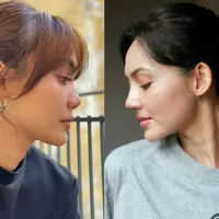 Rina Nose Curhat Bingung Adaptasi dengan Perubahan Wajahnya Pasca Oplas