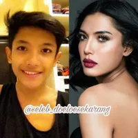 Sekarang Makin Feminin, Foto Lawas Millendaru Bikin Pangling!