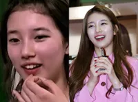 Selebritis Korea Ini Makin Menawan Setelah Memperbaiki Gigi