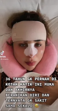 Sempat Dikira Wanita Tulen, 8 Potret Transgender Gebby Vesta Perdana Oplas Wajah di Usia 36 Tahun - Dipuji Makin Cantik Pasca Rombak Hidung dan Dahi