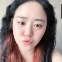 Sempat Sakit Langka, Moon Geun Young Pamer Visual Awet Muda Lewat Selfie Terbaru