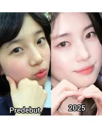 Transformasi Bae Suzy, Dari Sebelum Debut Sudah Cantik dan Diyakini Tak Lakukan Oplas