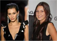 Transformasi Bella Hadid, Dulu Chubby Sekarang Punya Struktur Wajah Sempurna!