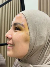Tya Ariestya Dapat Delapan Jahitan di Muka Setelah Terjatuh