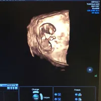 Usia Kandungan 14 Minggu, Selvi KItty Mulai Pamer Baby Bump