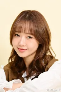 Visual Choi Yoo Jung Jadi Perbincangan, Netizen Soroti Perubahan di Hidung