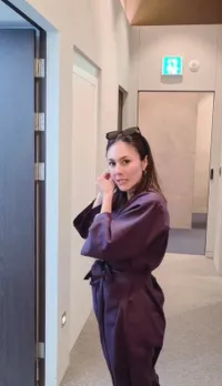 Wulan Guritno Jalani Oplas di Korea, Akui Nyaris Tanpa Rasa Sakit