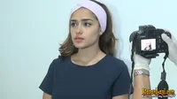Yasmin Wildblood Ketakutan Saat Perawatan, Muka Disuntik 10 Kali!
