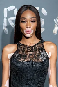 Foto Winnie Harlow