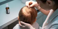 Cara Menggunakan Peditox untuk Membasmi Kutu Rambut dengan Efektif